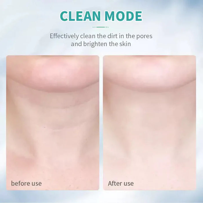 Anti-Falten- und Facelift-Massagegerät für Gesicht und Hals